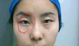 小孩爆料妈妈双眼皮视频,小孩视频意外曝光惊人真相